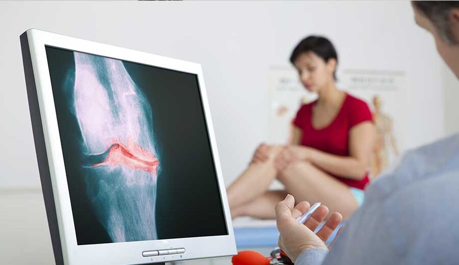 Consultați un medic dacă se suspectează artrită sau artroză