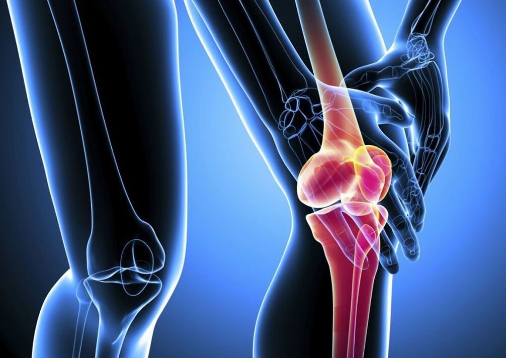 Durerea în timpul activității fizice în osteoartrita articulației genunchiului