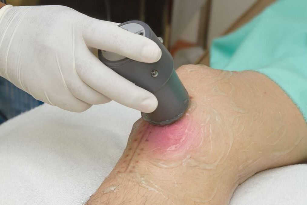 Procedura de fonoforeză pentru artrita articulației genunchiului