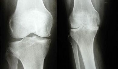 Metode de diagnostic a genunchiului