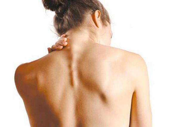 Fata are osteocondroză cervicală