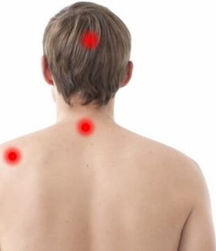 locul durerii în osteocondroza cervicală