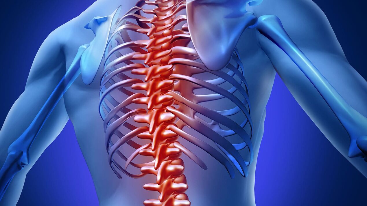 Osteocondroza toracică